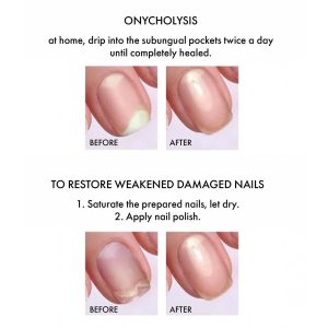 Antifungal 9 ml EMI - nagu augšanas stimulators un pretsēnīšu līdzeklis